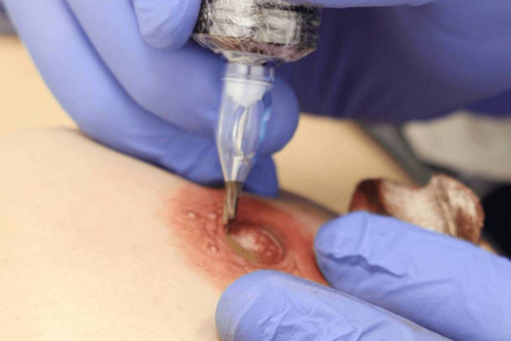 micropigmentacion oncologica 3